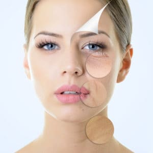 Khắc phục da lão hóa sớm