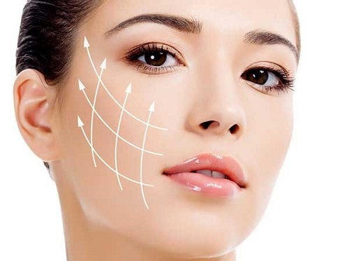 căng da mặt không cần phẫu thuật
